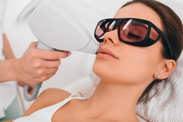 Épilation au laser du visage